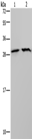 Anti-ETFB Rabbit Polyclonal Antibody