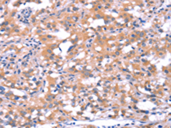 Anti-FAT1 Rabbit Polyclonal Antibody