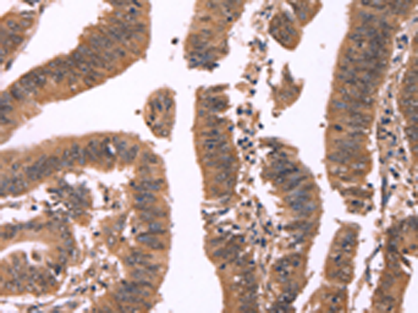 Anti-FBXO31 Rabbit Polyclonal Antibody