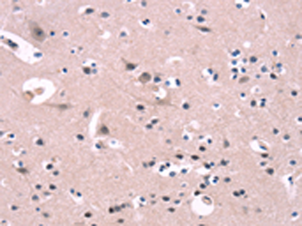 Anti-FGF16 Rabbit Polyclonal Antibody
