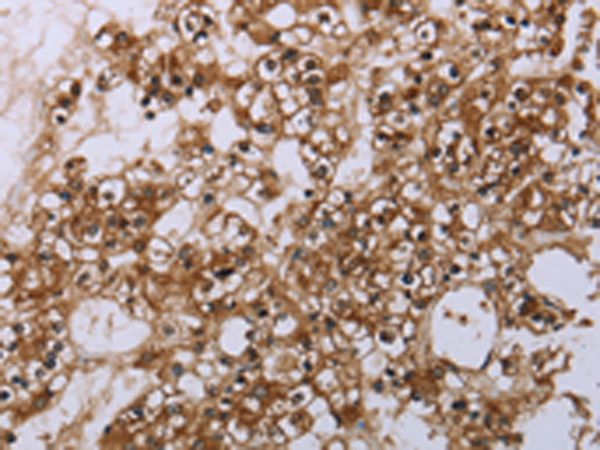 Anti-FLASH Rabbit Polyclonal Antibody