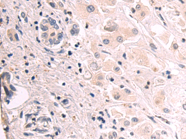 Anti-FUT8 Rabbit Polyclonal Antibody