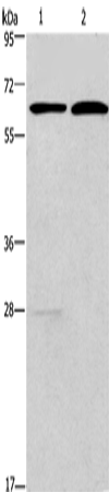 Anti-FUT8 Rabbit Polyclonal Antibody
