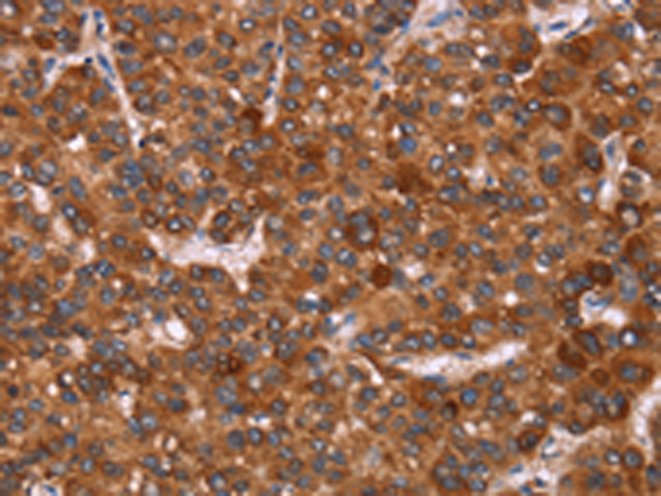 Anti-GAGE12I Rabbit Polyclonal Antibody