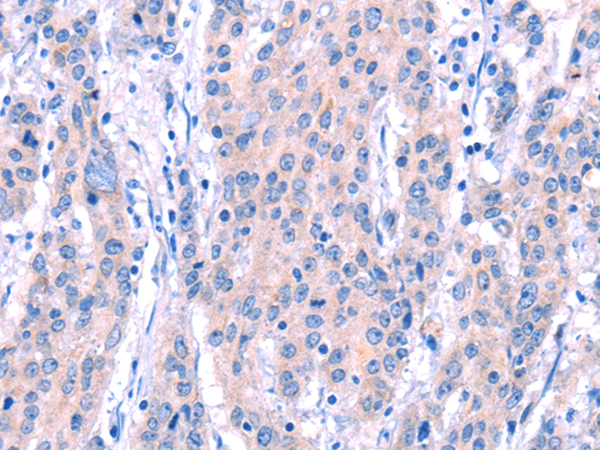Anti-GALC Rabbit Polyclonal Antibody