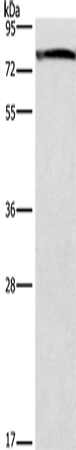 Anti-GALC Rabbit Polyclonal Antibody