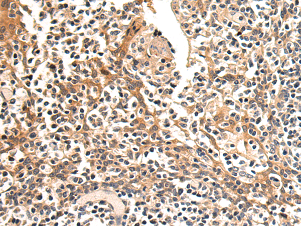 Anti-GCGR Rabbit Polyclonal Antibody