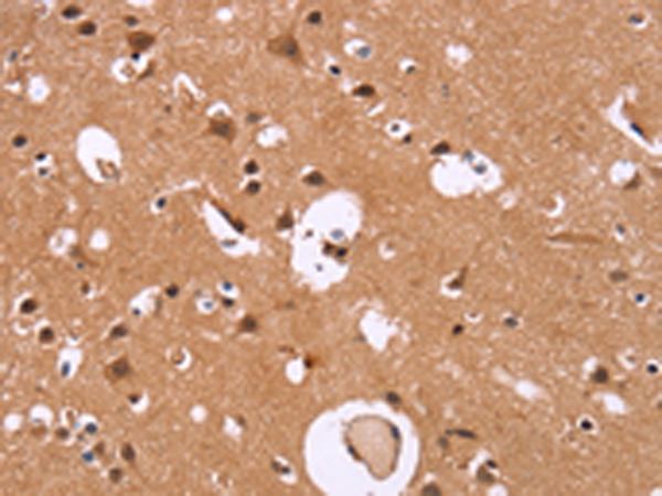 Anti-HDLBP Rabbit Polyclonal Antibody