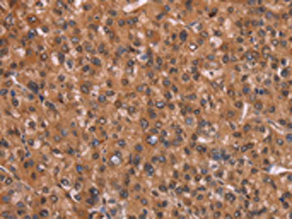 Anti-HINT1 Rabbit Polyclonal Antibody