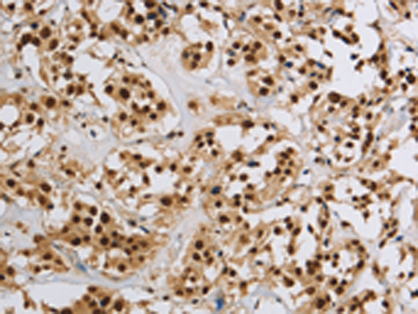 Anti-Histone H2A Rabbit Polyclonal Antibody