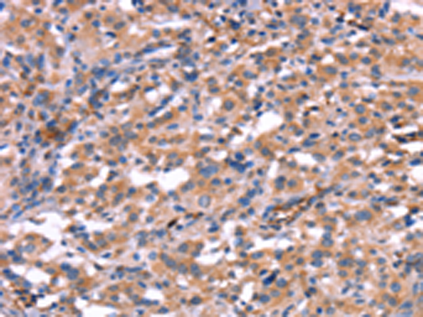 Anti-HMGCS1 Rabbit Polyclonal Antibody