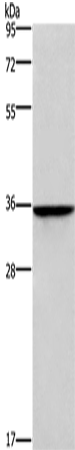 Anti-HOXB2 Rabbit Polyclonal Antibody