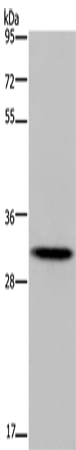 Anti-HOXB8 Rabbit Polyclonal Antibody