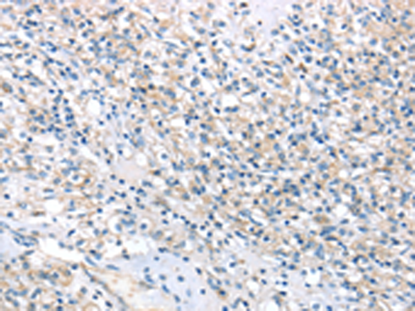 Anti-HSD11B2 Rabbit Polyclonal Antibody