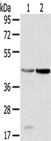 Anti-HSD11B2 Rabbit Polyclonal Antibody