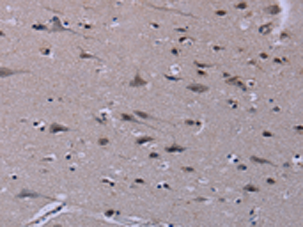 Anti-ID3 Rabbit Polyclonal Antibody