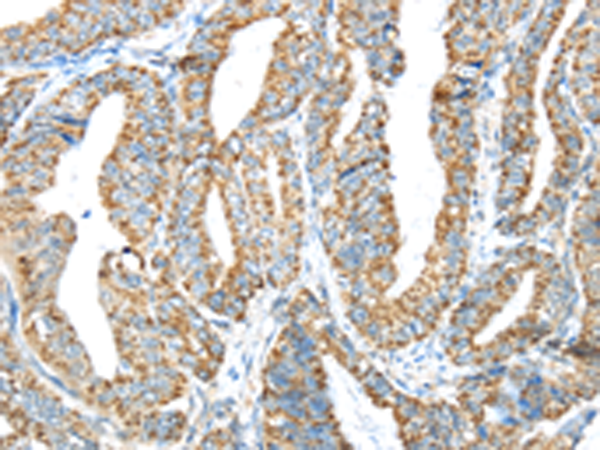 Anti-Interferon alpha 2 Rabbit Polyclonal Antibody