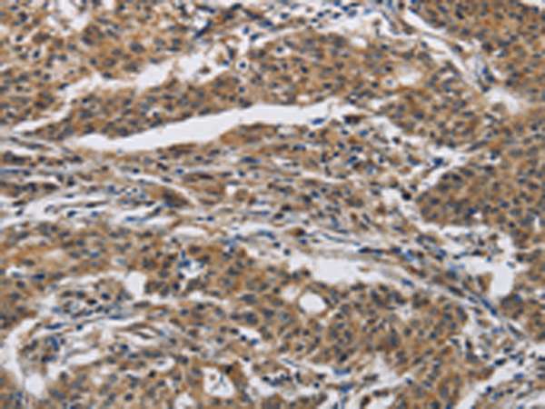 Anti-Interferon gamma Receptor 2 Rabbit Polyclonal Antibody