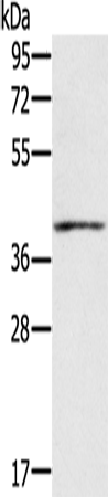 Anti-Interferon gamma Receptor 2 Rabbit Polyclonal Antibody