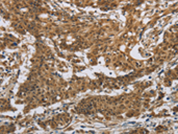 Anti-IL-5 Receptor alpha Rabbit Polyclonal Antibody
