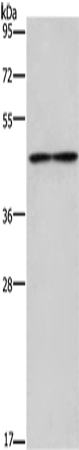 Anti-IL-5 Receptor alpha Rabbit Polyclonal Antibody