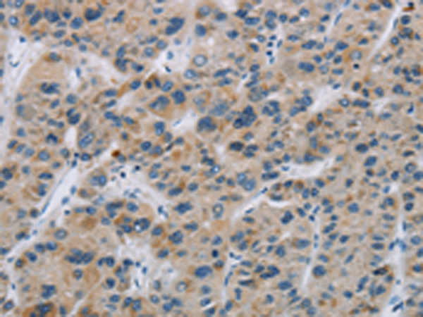 Anti-Synapsin 2 Rabbit Polyclonal Antibody