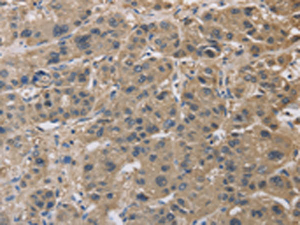 Anti-IMPDH1 Rabbit Polyclonal Antibody