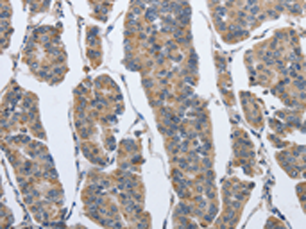 Anti-IPO7 Rabbit Polyclonal Antibody