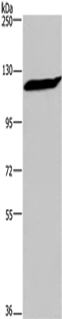 Anti-IPO7 Rabbit Polyclonal Antibody