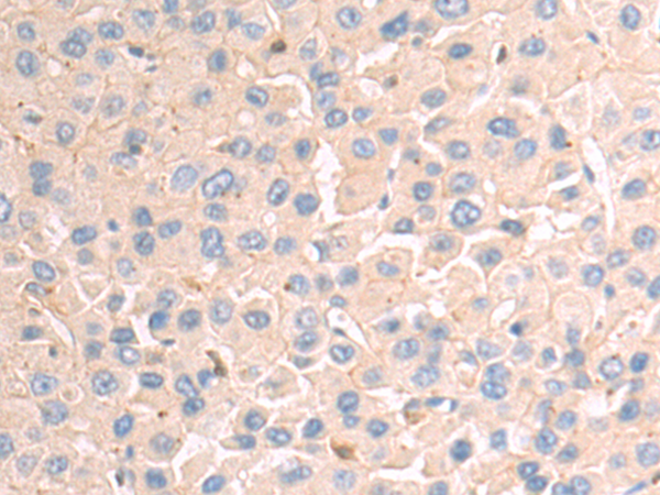 Anti-Integrin alpha 11 Rabbit Polyclonal Antibody