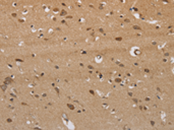Anti-ITPR3 Rabbit Polyclonal Antibody