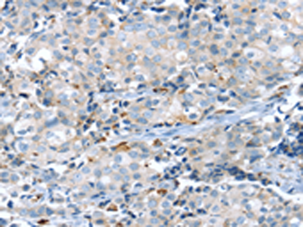 Anti-KCNG3 Rabbit Polyclonal Antibody
