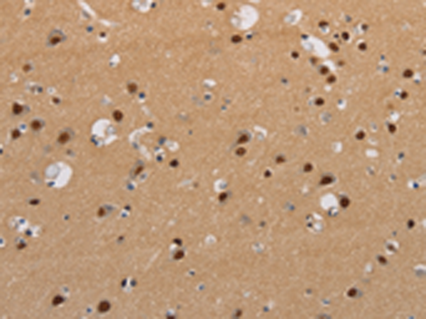 Anti-KCNG4 Rabbit Polyclonal Antibody