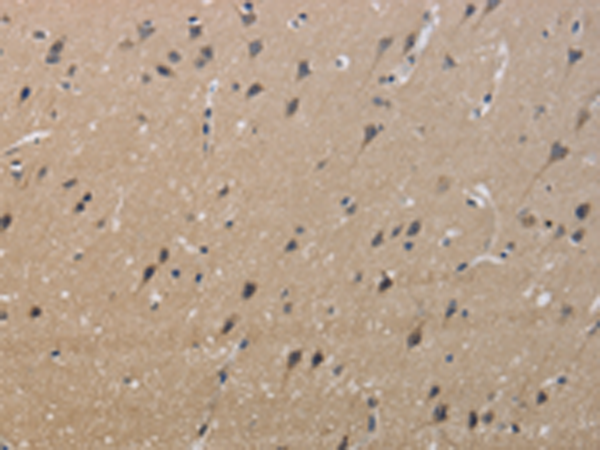 Anti-KCNMB4 Rabbit Polyclonal Antibody