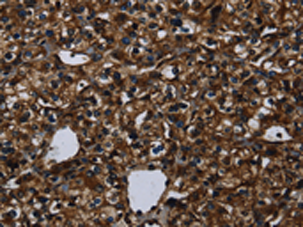 Anti-Kallikrein 14 Rabbit Polyclonal Antibody