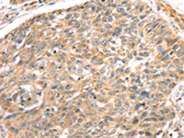 Anti-LONP1 Rabbit Polyclonal Antibody