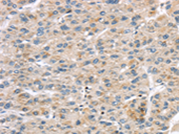 Anti-LZTS1 Rabbit Polyclonal Antibody