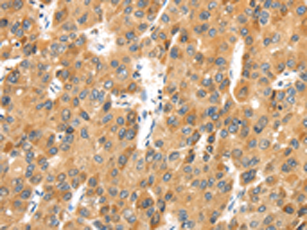 Anti-MACC1 Rabbit Polyclonal Antibody
