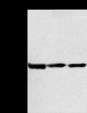 Anti-AGPAT9 Rabbit Polyclonal Antibody