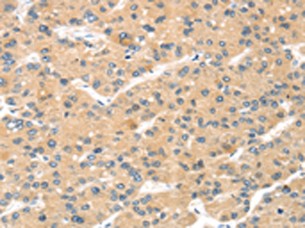 Anti-MAGEA11 Rabbit Polyclonal Antibody