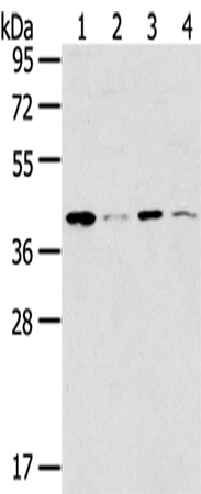 Anti-MAGEA11 Rabbit Polyclonal Antibody