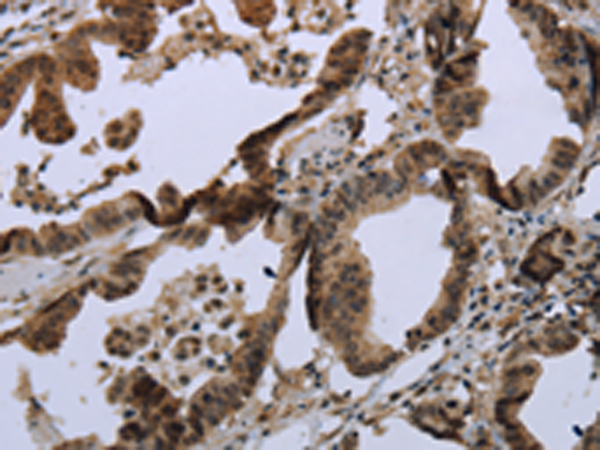 Anti-MAPKAP Kinase 2 Rabbit Polyclonal Antibody