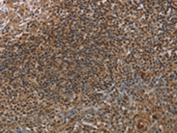 Anti-MARK1 Rabbit Polyclonal Antibody