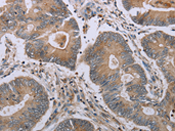 Anti-MAVS Rabbit Polyclonal Antibody