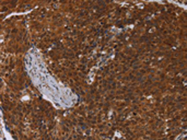 Anti-MCHR1 Rabbit Polyclonal Antibody