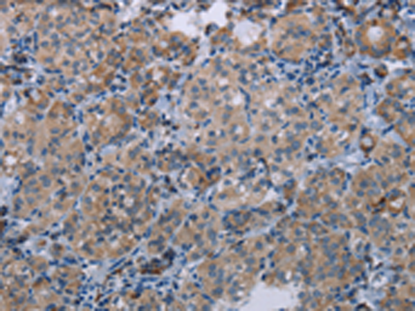 Anti-MFSD2A Rabbit Polyclonal Antibody