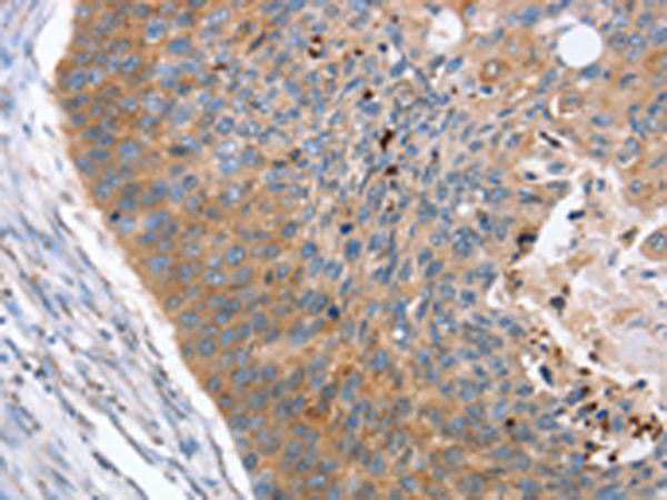 Anti-REG3A Rabbit Polyclonal Antibody