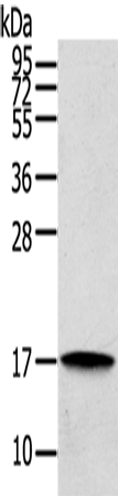 Anti-REG3A Rabbit Polyclonal Antibody