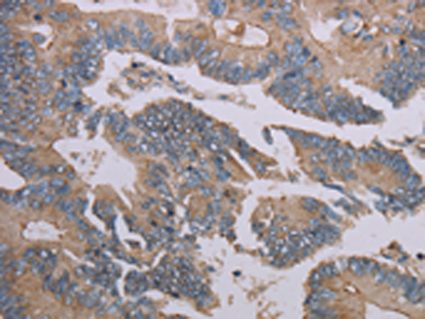 Anti-MMP20 Rabbit Polyclonal Antibody