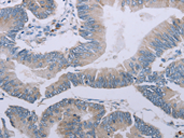 Anti-MRGPRX1 Rabbit Polyclonal Antibody